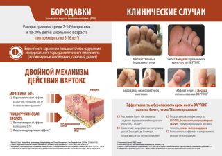 Буклет (разворот) наглядно отражает высокую эффективность и безопасность при использовании крем-пасты Вартокс для удаления бородавок сложной локализации около ногтевых пластин или множественных бородавок. Удаление бородавки не привело к травматизации ногтевой пластины и способствовало отрастанию здорового ногтя, без рубцов и дефектов.<br />
